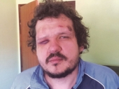 Policija uhapsila napadača na banjskog odbornika 